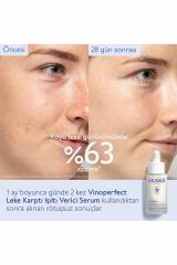 Vinoperfect Serum 30 ml