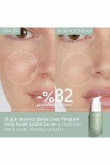 Vinopure Salisilik Serum 30 ml