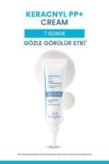 Yağlı Ve Akneye Eğilimli Ciltler Için Bakım Kremi 30ml